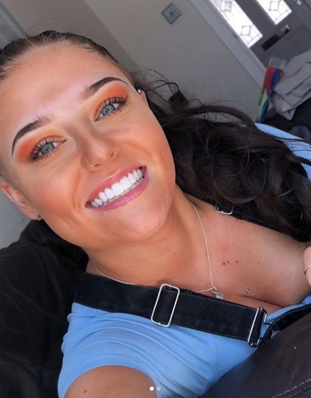 Best True Smile Veneers-Get Veneers On Sale - Ezaky