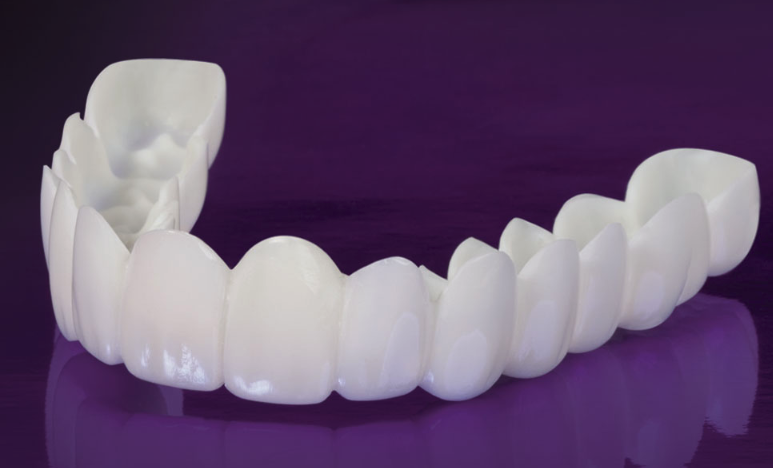 get veneers near me - ehabal