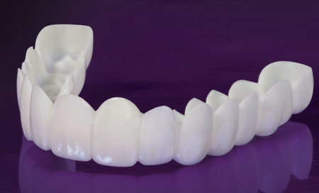 Snap On Veneers. - ZefTe
