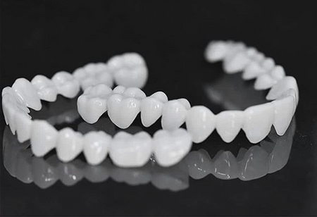 Comfortable Snap-On Veneers – A Sleek Appearance