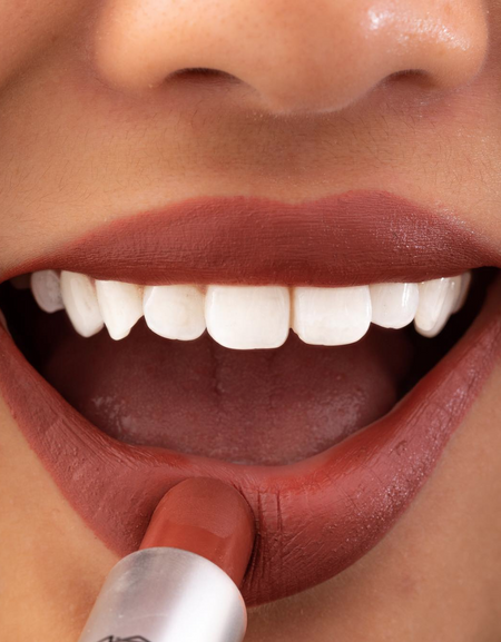 Snap-On Smile Veneers!