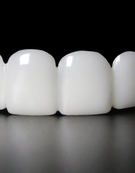 How Much Do Veneers Cost - ZefTe
