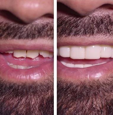 AMAZING PERFECT& CONFIDENT SMILE - ZefTe
